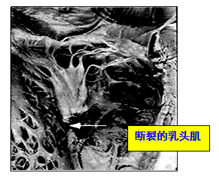 微信截图_20221103170317.png