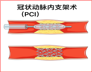 高龄爷爷的春天5.png