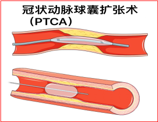 高龄爷爷的春天6.png