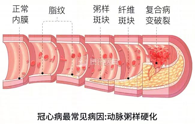 55.png 图片